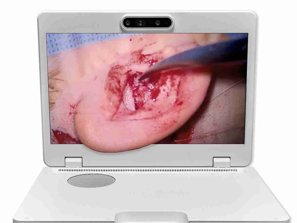 达擎之＂Heads-up 3D显微手术显示系统＂，，整合4K裸眼3D显示及眼球追踪系统，，，具备快速追踪人眼移动位置功能，，减轻医师长时间维持固定姿势的负担，，，让医师能有更宽广清晰的3D立体视野及更舒适的姿势来执行手术。。。